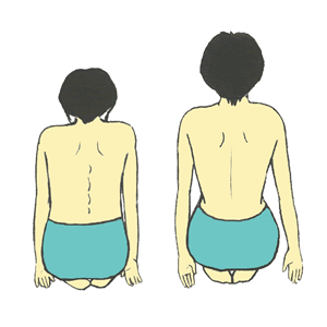 腰椎の出具合チェック