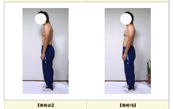 背中の痛みの改善例