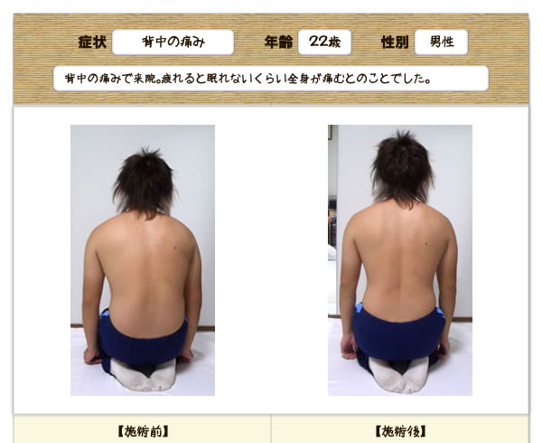 背中の痛みの改善例