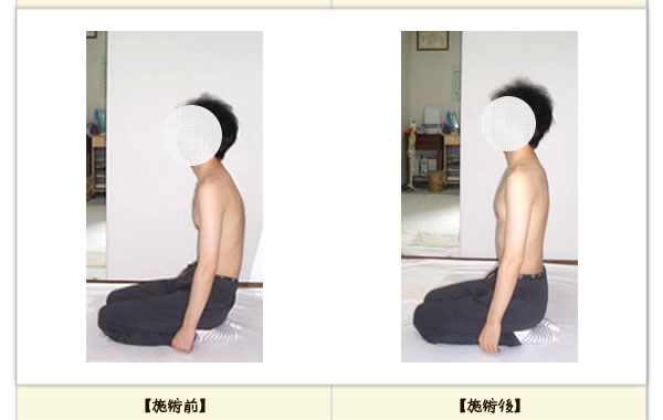 しびれの改善例