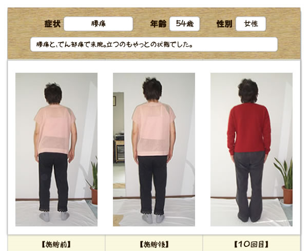 腰痛の改善例