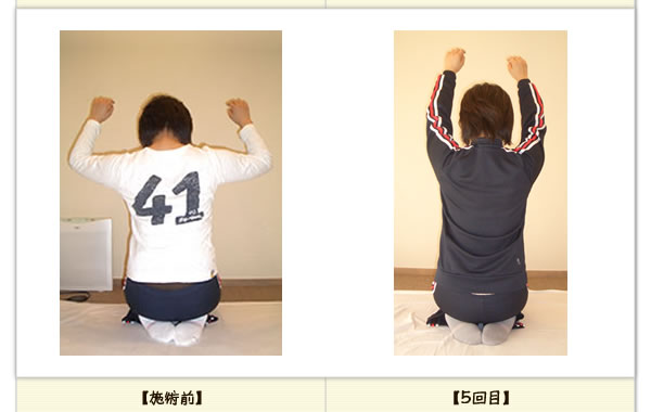 頭痛・腰痛の改善例