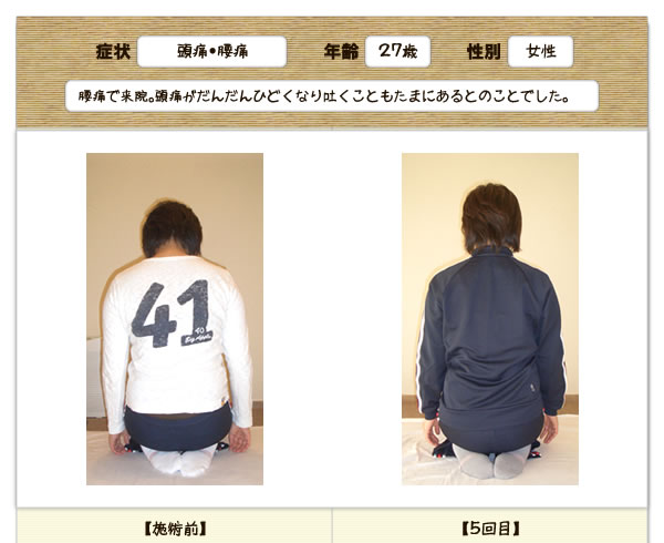 頭痛・腰痛の改善例