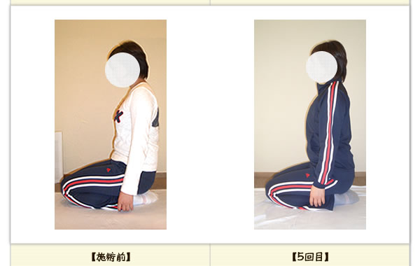 頭痛・腰痛の改善例