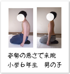 姿勢の悪さ　小学６年生　男の子
