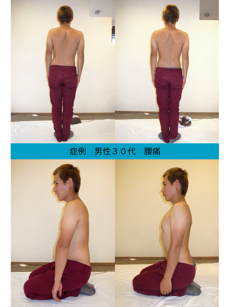 腰痛の改善例