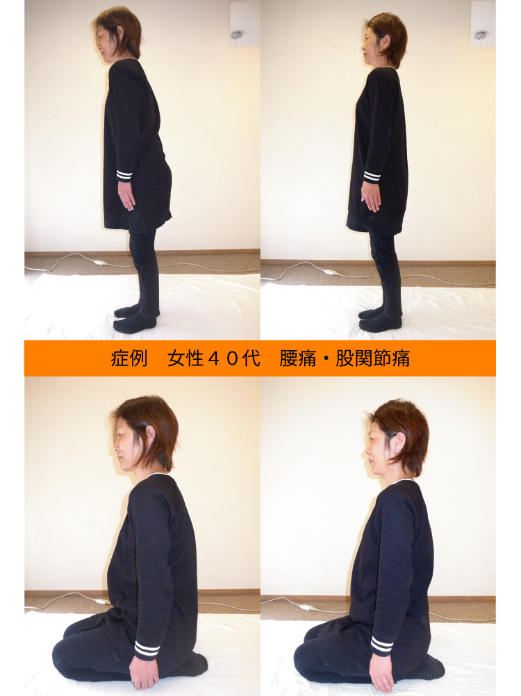 腰痛・股関節痛の改善例
