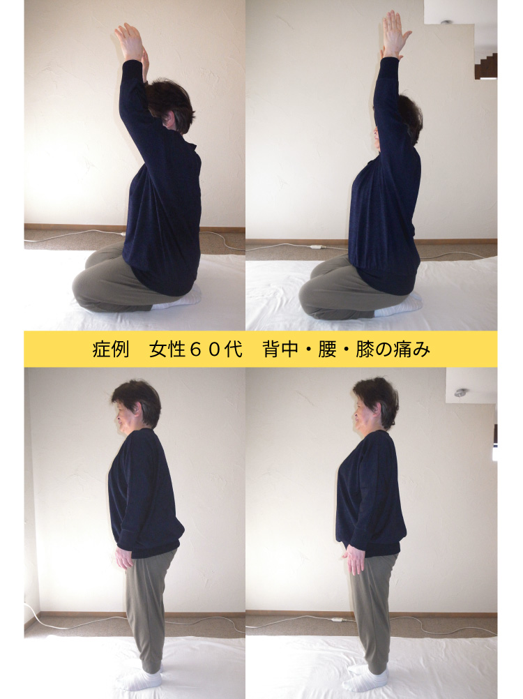 症例女性背中・腰痛・膝痛