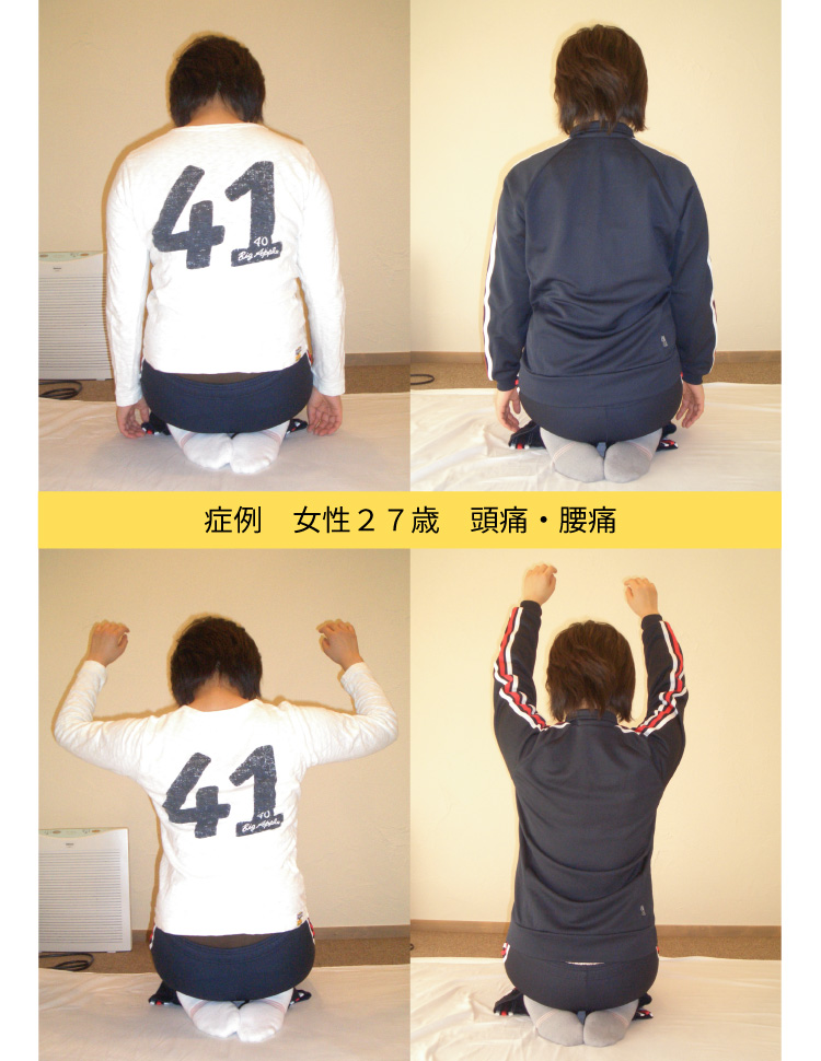 症例女性頭痛・腰痛
